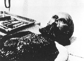 ロズウェル事件の解剖される直前の6本指異星人